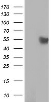 Anti-FBXO21 mouse monoclonal antibody (TA504013) immunofluorescent staining of COS7 cells transiently transfected by pCMV6-ENTRY FBXO21 (RC223095).