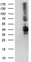 Immunohistochemistry of RIP1 in human placenta tissue with RIP1 antibody at 10ug/mL.