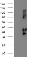 HEK293T cells were transfected with the pCMV6-ENTRY control (Left lane) or pCMV6-ENTRY SERPINB2 (RC203139, Right lane) cDNA for 48 hrs and lysed. Equivalent amounts of cell lysates (5 ug per lane) were separated by SDS-PAGE and immunoblotted with anti-SERPINB2. Positive lysates LY400915 (100 ug) and LC400915 (20 ug) can be purchased separately from OriGene.