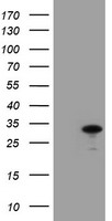 Western blot analysis of SPT2 in 3T3 cell lysate with SPT2 antibody at 1ug/mL in (A) the absence and (B) the presence of blocking peptide.
