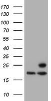 Western blot analysis of AGR2 in Hela cell lysate with AGR2 antibody at (A) 1 and (B) 2ug/mL