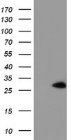 Western blot analysis of PIAS4 in rat brain tissue lysate with PIAS4 antibody at 1ug/mL in (A) the absence and (B) the presence of blocking peptide.