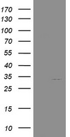 HEK293T cells were transfected with the pCMV6-ENTRY control (Left lane) or pCMV6-ENTRY EPN2 (RC213652, Right lane) cDNA for 48 hrs and lysed. Equivalent amounts of cell lysates (5 ug per lane) were separated by SDS-PAGE and immunoblotted with anti-EPN2.