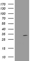 HEK293T cells were transfected with the pCMV6-ENTRY control (Left lane) or pCMV6-ENTRY EPN2 (RC213652, Right lane) cDNA for 48 hrs and lysed. Equivalent amounts of cell lysates (5 ug per lane) were separated by SDS-PAGE and immunoblotted with anti-EPN2.