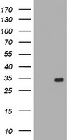 HEK293T cells were transfected with the pCMV6-ENTRY control (Left lane) or pCMV6-ENTRY DTNB (RC203798, Right lane) cDNA for 48 hrs and lysed. Equivalent amounts of cell lysates (5 ug per lane) were separated by SDS-PAGE and immunoblotted with anti-DTNB. Positive lysates LY405251 (100 ug) and LC405251 (20 ug) can be purchased separately from OriGene.