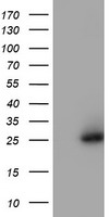HEK293T cells were transfected with the pCMV6-ENTRY control (Left lane) or pCMV6-ENTRY FOLH1 (RC218310, Right lane) cDNA for 48 hrs and lysed. Equivalent amounts of cell lysates (5 ug per lane) were separated by SDS-PAGE and immunoblotted with anti-FOLH1. Positive lysates LY429203 (100 ug) and LC429203 (20 ug) can be purchased separately from OriGene.