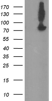 HEK293T cells were transfected with the pCMV6-ENTRY control (Left lane) or pCMV6-ENTRY NONO (RC206688, Right lane) cDNA for 48 hrs and lysed. Equivalent amounts of cell lysates (5 ug per lane) were separated by SDS-PAGE and immunoblotted with anti-NONO. Positive lysates LY402135 (100 ug) and LC402135 (20 ug) can be purchased separately from OriGene.