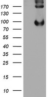 HEK293T cells were transfected with the pCMV6-ENTRY control (Left lane) or pCMV6-ENTRY NONO (RC206688, Right lane) cDNA for 48 hrs and lysed. Equivalent amounts of cell lysates (5 ug per lane) were separated by SDS-PAGE and immunoblotted with anti-NONO. Positive lysates LY402135 (100 ug) and LC402135 (20 ug) can be purchased separately from OriGene.