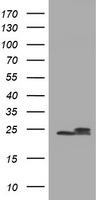 HEK293T cells were transfected with the pCMV6-ENTRY control (Left lane) or pCMV6-ENTRY SENP2 (RC208109, Right lane) cDNA for 48 hrs and lysed. Equivalent amounts of cell lysates (5 ug per lane) were separated by SDS-PAGE and immunoblotted with anti-SENP2.