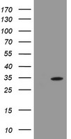 HEK293T cells were transfected with the pCMV6-ENTRY control (Left lane) or pCMV6-ENTRY SENP2 (RC208109, Right lane) cDNA for 48 hrs and lysed. Equivalent amounts of cell lysates (5 ug per lane) were separated by SDS-PAGE and immunoblotted with anti-SENP2.