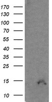 HEK293T cells were transfected with the pCMV6-ENTRY control (Left lane) or pCMV6-ENTRY FTCD (RC208573, Right lane) cDNA for 48 hrs and lysed. Equivalent amounts of cell lysates (5 ug per lane) were separated by SDS-PAGE and immunoblotted with anti-FTCD. Positive lysates LY416500 (100 ug) and LC416500 (20 ug) can be purchased separately from OriGene.