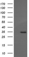 Gel: 10%SDS-PAGE<br>Lysate: 40 μg<br>Lane: Hela cells<br>Primary antibody: TA321512 (PPP1CB Antibody) at dilution 1/450<br>Secondary antibody: Goat anti rabbit IgG at 1/8000 dilution<br>Exposure time: 20 seconds