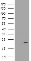 HEK293T cells were transfected with the pCMV6-ENTRY control (Left lane) or pCMV6-ENTRY FATE1 (RC205951, Right lane) cDNA for 48 hrs and lysed. Equivalent amounts of cell lysates (5 ug per lane) were separated by SDS-PAGE and immunoblotted with anti-FATE1. Positive lysates LY409735 (100 ug) and LC409735 (20 ug) can be purchased separately from OriGene.