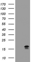 Gel: 6%SDS-PAGE<br>Lysate: 40 μg<br>Lane: Mouse kidney tissue lysate<br>Primary antibody: TA321651 (CDH1 Antibody) at dilution 1/200<br>Secondary antibody: Goat anti rabbit IgG at 1/8000 dilution<br>Exposure time: 20 seconds
