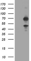 HEK293T cells were transfected with the pCMV6-ENTRY control (Left lane) or pCMV6-ENTRY TRMT2A (RC221181, Right lane) cDNA for 48 hrs and lysed. Equivalent amounts of cell lysates (5 ug per lane) were separated by SDS-PAGE and immunoblotted with anti-TRMT2A. Positive lysates LY411594 (100ug) and LC411594 (20ug) can be purchased separately from OriGene.