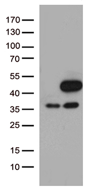 /assets/images/antibody/100/ta505700-1-w.jpg