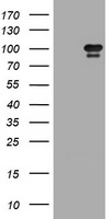HEK293T cells were transfected with the pCMV6-ENTRY control (Left lane) or pCMV6-ENTRY CRYAA (RC216946, Right lane) cDNA for 48 hrs and lysed. Equivalent amounts of cell lysates (5 ug per lane) were separated by SDS-PAGE and immunoblotted with anti-CRYAA. Positive lysates LY424743 (100 ug) and LC424743 (20 ug) can be purchased separately from OriGene.
