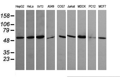 Immunofluorescent staining of HeLa cells using anti-HRAS mouse monoclonal antibody (TA505669).