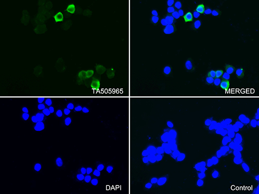/assets/images/antibody/100/ta505965-1-f.jpg
