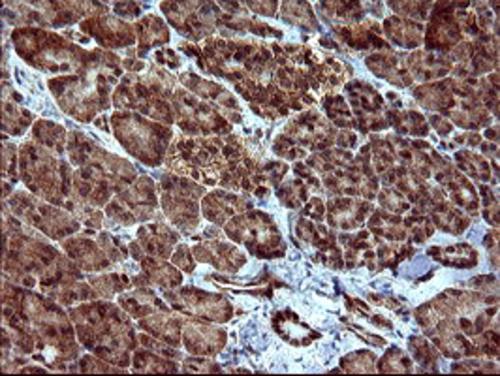 Immunohistochemical staining of paraffin-embedded Human pancreas tissue within the normal limits using anti-DOCK8 mouse monoclonal antibody. (Heat-induced epitope retrieval by 10mM citric buffer, pH6.0, 120°C for 3min, TA506365)