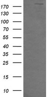 HEK293T cells were transfected with the pCMV6-ENTRY control (Left lane) or pCMV6-ENTRY DOCK8 (RC222789, Right lane) cDNA for 48 hrs and lysed. Equivalent amounts of cell lysates (5 ug per lane) were separated by SDS-PAGE and immunoblotted with anti-DOCK8. Positive lysates LY404295 (100ug) and LC404295 (20ug) can be purchased separately from OriGene.