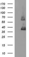 HEK293T cells were transfected with the pCMV6-ENTRY control (Left lane) or pCMV6-ENTRY TGFB1 (RC200973, Right lane) cDNA for 48 hrs and lysed. Equivalent amounts of cell lysates (5 ug per lane) were separated by SDS-PAGE and immunoblotted with anti-TGFB1.