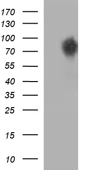 HEK293T cells were transfected with the pCMV6-ENTRY control (Left lane) or pCMV6-ENTRY CEP68 (RC200798, Right lane) cDNA for 48 hrs and lysed. Equivalent amounts of cell lysates (5 ug per lane) were separated by SDS-PAGE and immunoblotted with anti-CEP68. Positive lysates LY414743 (100ug) and LC414743 (20ug) can be purchased separately from OriGene.