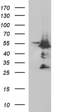 Anti-CHAF1B mouse monoclonal antibody (TA506840) immunofluorescent staining of COS7 cells transiently transfected by pCMV6-ENTRY CHAF1B (RC202858).