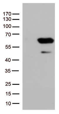 /assets/images/antibody/100/ta507240-1-w.jpg