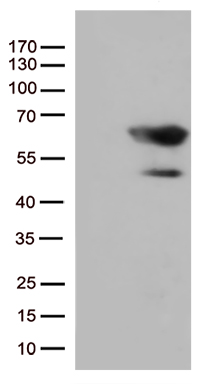 /assets/images/antibody/100/ta507243-1-w.jpg