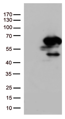 /assets/images/antibody/100/ta507244-1-w.jpg