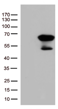 /assets/images/antibody/100/ta507245-1-w.jpg