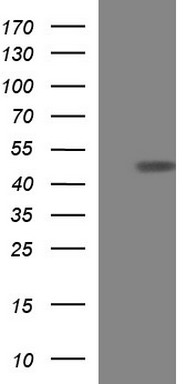 HEK293T cells were transfected with the pCMV6-ENTRY control (Left lane) or pCMV6-ENTRY SERPINB3 (RC202683, Right lane) cDNA for 48 hrs and lysed. Equivalent amounts of cell lysates (5 ug per lane) were separated by SDS-PAGE and immunoblotted with anti-SERPINB3. Positive lysates LY416321 (100 ug) and LC416321 (20 ug) can be purchased separately from OriGene.