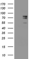 HRAS Luminex Elisa with 1G8 Capture (TA600224) and 1A1 Detection (TA700224) Antibodies. Substrate used: Recombinant Human HRAS (TP316409)