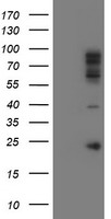 TIMP2 Elisa with 1A6 Capture (TA600235) and 2G7 Detection (TA700235) Antibodies. Substrate used: Recombinant Human TIMP2 (TP309796)