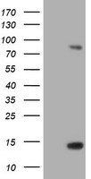TIMP2 Elisa with 3G7 Capture (TA600238) and 2G7 Detection (TA700235) Antibodies. Substrate used: Recombinant Human TIMP2 (TP309796)