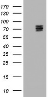 TIMP2 Elisa with 3G7 Capture (TA600238) and 3H8 Detection (TA700236) Antibodies. Substrate used: Recombinant Human TIMP2 (TP309796)