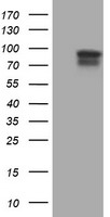 CST3 Luminex Elisa with Anti-Tag 1B12 Capture (TA600050) and 2C8 Detection (TA700251) Antibodies. Substrate used: Recombinant Human CST3 (TP310730)