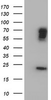 CST4 Luminex Elisa with 1B1 Capture (TA600264) and 1A3 Detection (TA700262) Antibodies. Substrate used: Recombinant Human CST4 (LY400707)