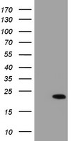 PCDH7 Luminex Elisa with 3C8 Capture (TA600266) and 1F7 Detection (TA700267) Antibodies. Substrate used: Recombinant Human PCDH7 (TP323033)