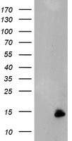 DTNB Luminex Elisa with 3C11 Capture (TA600287) and 3H8 Detection (TA700287) Antibodies. Substrate used: Recombinant Human DTNB (TP303798)