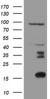 DTNB Luminex Elisa with 2E4 Capture (TA600288) and 3C11 Detection (TA700288) Antibodies. Substrate used: Recombinant Human DTNB (TP303798)