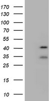 CYP17A1 Luminex Elisa with 5G10 Capture (TA600326) and 3D9 Detection (TA700326) Antibodies. Substrate used: Recombinant Human CYP17A1 (TP309042)