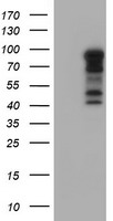 PARVA Elisa with 1H2 Capture (TA600346) and 3H2 Detection (TA700343) Antibodies. Substrate used: Recombinant Human PARVA (TP305086)