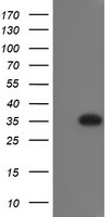 FGFR2 Luminex Elisa with 3F8 Capture (TA600369) and 1H5 Detection (TA700366) Antibodies. Substrate used: Recombinant Human FGFR2 (TP317098)