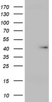TP63 Luminex Elisa with 5F3 Capture (TA600383) and 5A5 Detection (TA700383) Antibodies. Substrate used: Recombinant Human TP63 (TP308013)