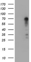 EPHX2 ELISA with 2F2 Capture (TA600405) and 1H5 Detection (TA700403) Antibodies. Substrate used: Recombinant Human EPHX2 (TP302489)