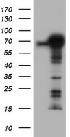 EFNA2 ELISA with 2C6 Capture (TA600412) and 4C3 Detection (TA700412) Antibodies. Substrate used: Recombinant Human EFNA2 (TP313728)