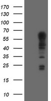 EFNA2 ELISA with 2B7 Capture (TA600413) and 3E3 Detection (TA700415) Antibodies. Substrate used: Recombinant Human EFNA2 (TP313728)