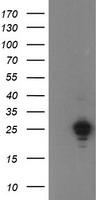 OTUB1 ELISA with 1E3 Capture (TA600425) and 5F7 Detection (TA700425) Antibodies. Substrate used: Recombinant Human OTUB1 (TP310648)